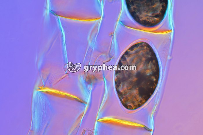 Spirogyre en conjugaison (algue filamenteuse)  - Cellules-oeufs ou zygotes x100 - gryphea.org